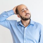 Hair Loss