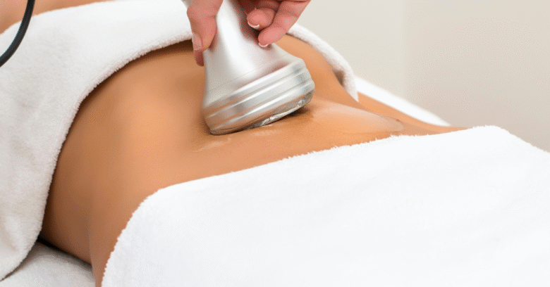 CoolSculpting