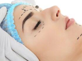 Cosmetic Surgeries