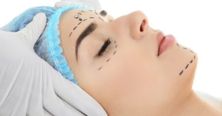 Cosmetic Surgeries