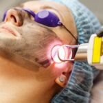 Laser Skin Resurfacing
