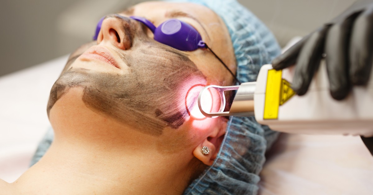 Laser Skin Resurfacing