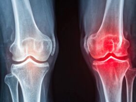 Cartilage in Your Knee